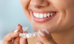 Ortodonzia invisibile